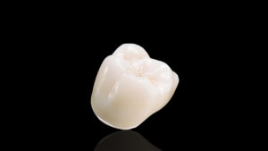 materiali-corone-dentali