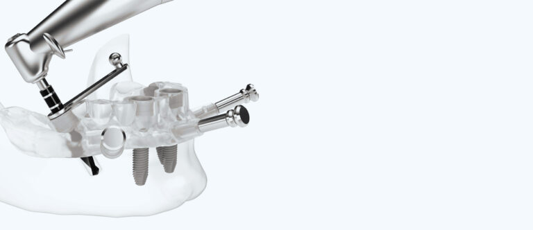 Implantologia computer guidata