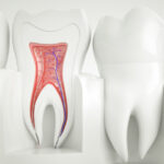 illustrazione di un dente da devitalizzare con polpa dentale e canali radicolari evidenziati